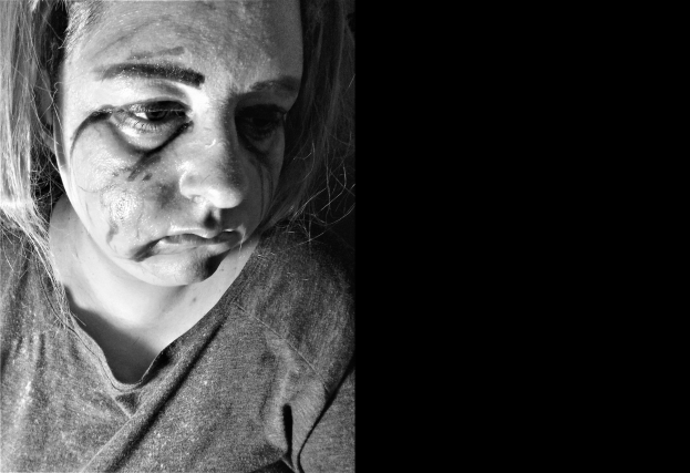 Schwarz-weiß-Foto einer Frau mit sichtbaren Gesichtsverletzungen, ernstem Gesichtsausdruck und zurückgebundenem Haar, die ein T-Shirt trägt.